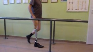 Proteza nogi - ćwiczenia