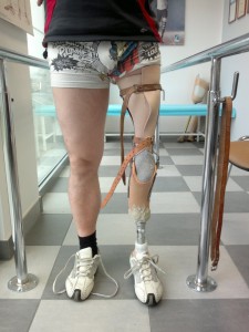 Indywidualna proteza lewej nogi
